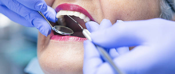 Best Emergency Dental Care for Broken or Chipped Teeth in Clifton Knolls Mill Creek, NY